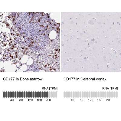 Immunohistochemistry-Paraffin: CD177 Antibody [NBP2-58979]
