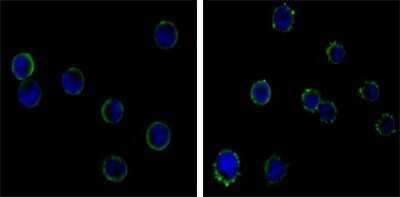 Immunocytochemistry/ Immunofluorescence: CD19 Antibody (2E2) - BSA Free [NBP2-22198]