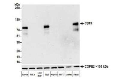 Western Blot: CD19 Antibody (BLR137H) [NBP3-14717]