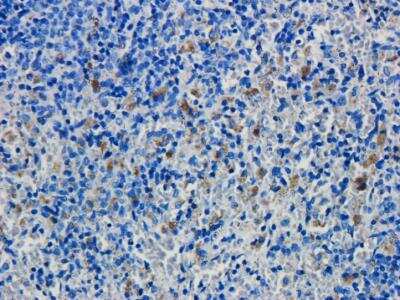 Immunohistochemical Detection of CD19 in Paraffin Embedded Rat Spleen