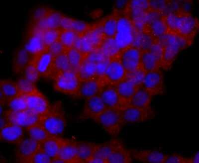 Immunocytochemistry/ Immunofluorescence: CD19 Antibody (JF100-06) [NBP2-67229]