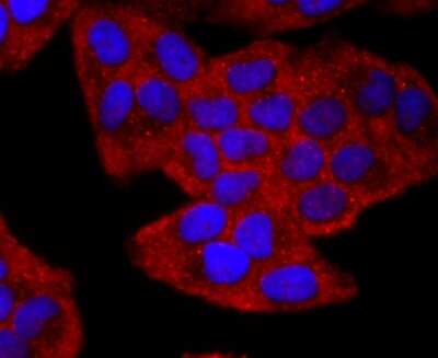 Immunocytochemistry/ Immunofluorescence: CD19 Antibody (JF100-06) [NBP2-67229]