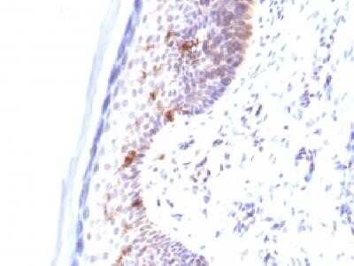 Immunohistochemistry-Paraffin: CD1a Antibody (C1A/711) - Azide and BSA Free [NBP2-34574]
