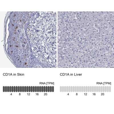 Immunohistochemistry-Paraffin: CD1a Antibody [NBP1-86560]