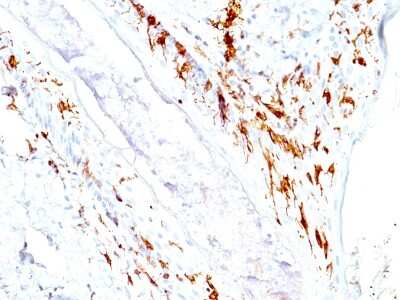 Immunohistochemistry-Paraffin: CD1a Antibody (O10+C1A/711) [NBP2-34314]