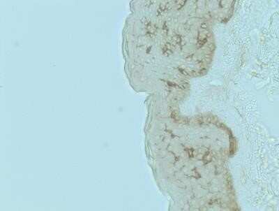 Immunohistochemistry: CD1a Antibody (O10) - IHC-Prediluted [NBP2-45341]
