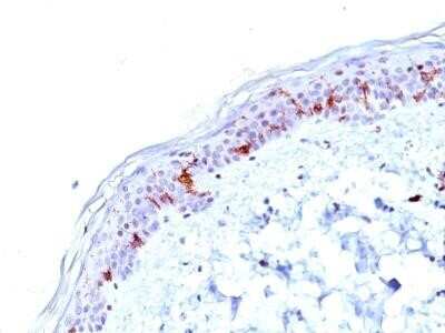 Immunohistochemistry-Paraffin: CD1a Antibody (O10) - IHC-Prediluted [NBP2-45341]