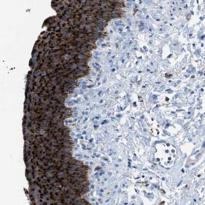 Immunohistochemistry-Paraffin: CD1b Antibody [NBP1-86559]