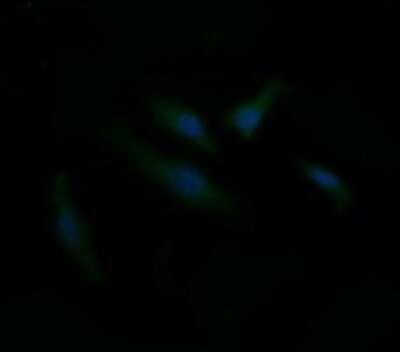 Immunocytochemistry/ Immunofluorescence: CD1c/BDCA-1 Antibody (OTI2F4) - Azide and BSA Free [NBP2-70345]