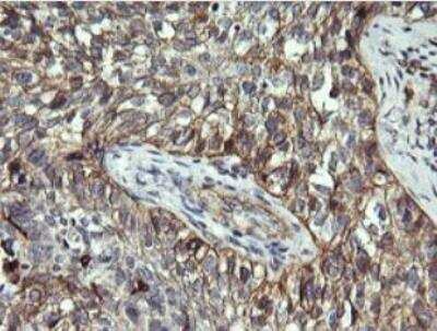 Immunohistochemistry-Paraffin: CD1c/BDCA-1 Antibody (OTI2F4) - Azide and BSA Free [NBP2-70345]