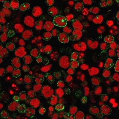 Immunocytochemistry/ Immunofluorescence: CD2 Antibody (1E7E8.G4) - Azide and BSA Free [NBP2-34523]