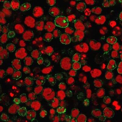Immunocytochemistry/ Immunofluorescence: CD2 Antibody (1E7E8.G4) [NBP2-32814]