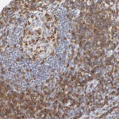 Immunohistochemistry: CD2 Antibody [NBP1-87005]