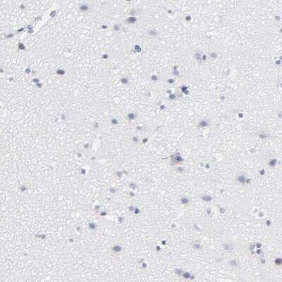 Immunohistochemistry-Paraffin: CD2 Antibody [NBP1-87005]