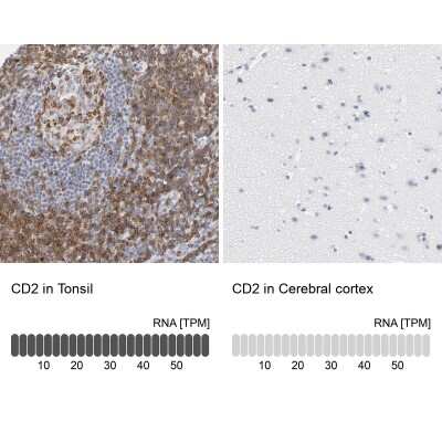 Immunohistochemistry-Paraffin: CD2 Antibody [NBP1-87005]