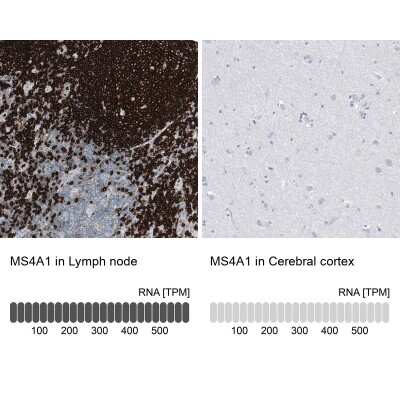 Immunohistochemistry-Paraffin: CD20 Antibody (CL10613) [NBP3-07979]