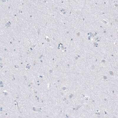 Immunohistochemistry-Paraffin: CD20 Antibody (CL10613) [NBP3-07979]