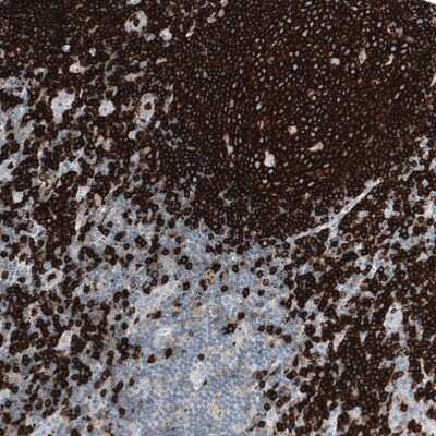 Immunohistochemistry-Paraffin: CD20 Antibody (CL10613) [NBP3-07979]