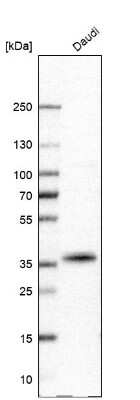 Western Blot: CD20 Antibody (CL10613) [NBP3-07979]