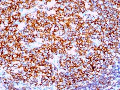 Immunohistochemistry-Paraffin: CD20 Antibody (IGEL/1497R) - Azide and BSA Free [NBP2-49873]