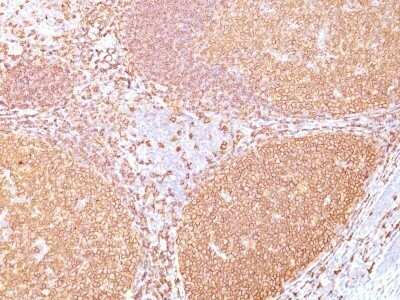 Immunohistochemistry-Paraffin: CD20 Antibody (IGEL/773) - Azide and BSA Free [NBP2-47840]