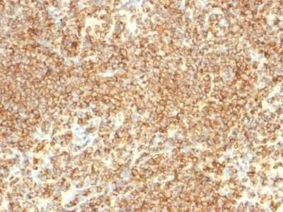 Immunohistochemistry-Paraffin: CD20 Antibody (IGEL/773) [NBP2-44745]