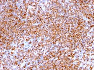 Immunohistochemistry-Paraffin: CD20 Antibody (IGEL/773) [NBP2-44745]