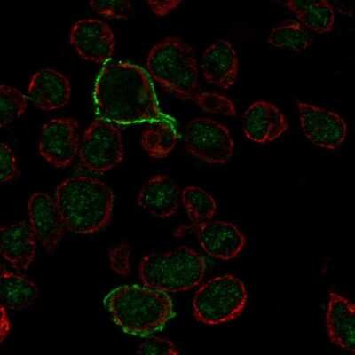 Immunocytochemistry/ Immunofluorescence: CD20 Antibody [NBP1-90051]