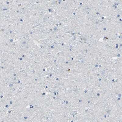 Immunohistochemistry-Paraffin: CD20 Antibody [NBP1-90052]