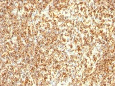 Immunohistochemistry-Paraffin: CD20 Antibody (L26 + IGEL/773) [NBP2-44747]