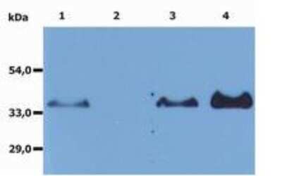 Immunoprecipitation: CD20 Antibody (MEM-97) - Azide and BSA Free [NBP1-44634]