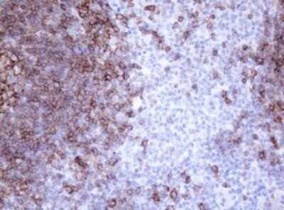 Immunohistochemistry: CD20 Antibody (OTI4B4) - Azide and BSA Free [NBP2-70362]