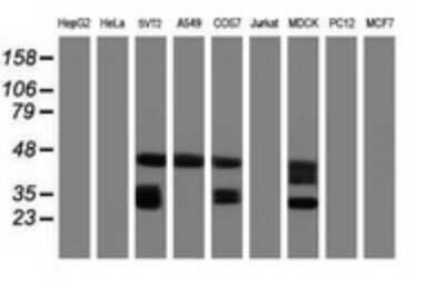 Western Blot: CD20 Antibody (OTI4B4)Azide and BSA Free [NBP2-70362]