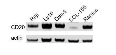 Western Blot: CD20 Antibody (OTI4B4) [NBP2-45454]