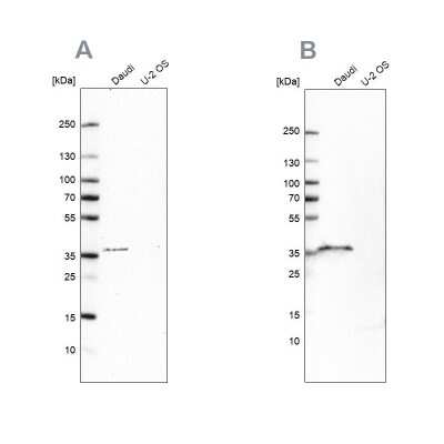 Western Blot: CD20 Antibody [NBP1-90052]