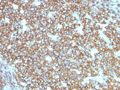 Immunohistochemistry-Paraffin: CD20 Antibody (rIGEL/773) - Azide and BSA Free [NBP2-54591]