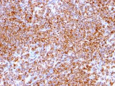 Immunohistochemistry-Paraffin: CD20 Antibody (rIGEL/773) - Azide and BSA Free [NBP2-54591]
