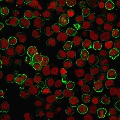 Immunocytochemistry/ Immunofluorescence: CD20 Antibody (rIGEL/773) [NBP2-53190]