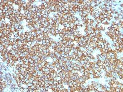 Immunohistochemistry-Paraffin: CD20 Antibody (rIGEL/773) [NBP2-53190]