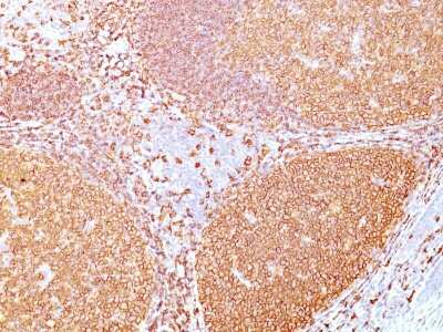 Immunohistochemistry-Paraffin: CD20 Antibody (rIGEL/773) [NBP2-53190]