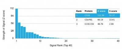 Protein Array: CD20 Antibody (rIGEL/773) [NBP2-53190]