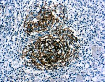 Immunohistochemistry-Paraffin: CD21 Antibody (1F8) [NBP1-22527]
