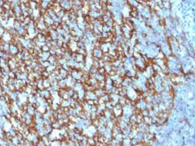 Immunohistochemistry-Paraffin: CD21 Antibody (CR2/1952) - Azide and BSA Free [NBP2-60733]