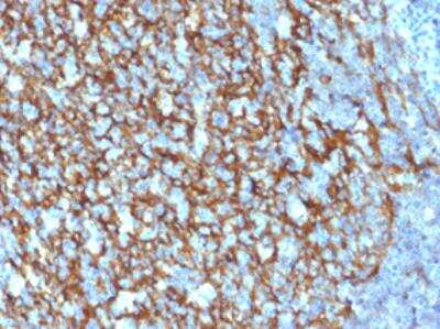 Immunohistochemistry-Paraffin: CD21 Antibody (CR2/1952) [NBP2-60732]