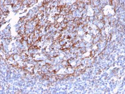 Immunohistochemistry-Paraffin: CD21 Antibody (CR2/3124R) - Azide and BSA Free [NBP3-08297]