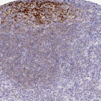 Immunohistochemistry-Paraffin: CD21 Antibody [NBP2-38684]
