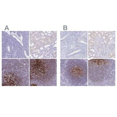 Immunohistochemistry-Paraffin: CD21 Antibody [NBP2-38895]