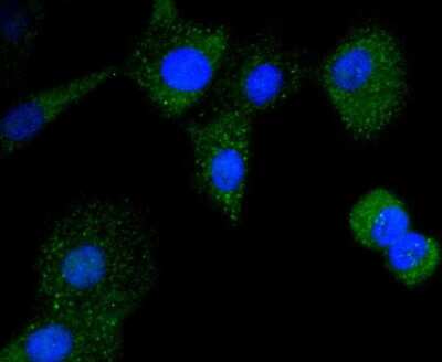 Immunocytochemistry/ Immunofluorescence: CD21 Antibody (SC0681) [NBP2-67605]