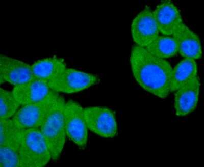 Immunocytochemistry/ Immunofluorescence: CD21 Antibody (SC0681) [NBP2-67605]