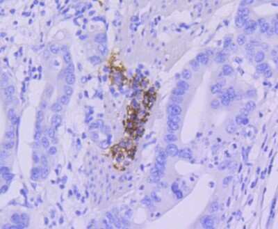 Immunohistochemistry-Paraffin: CD21 Antibody (SC0681) [NBP2-67605]